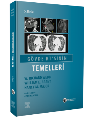 Gövde BT 'sinin Temelleri Radyoloji ve Radyasyon Onkolojisi Çetin İmam