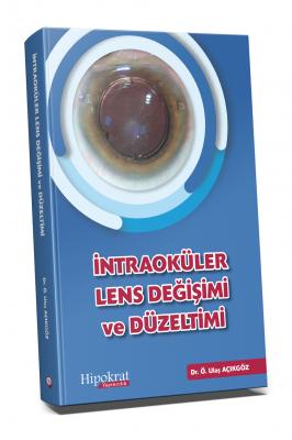 İntraoküler Lens Değişimi ve Düzeltimi Türkçe Tıp Kitapları Ö. Ulaş Aç
