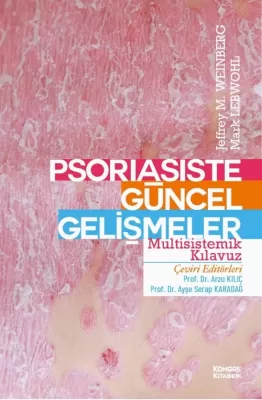 Psoriasiste Güncel Gelişmeler Multisistemik Klavuzu