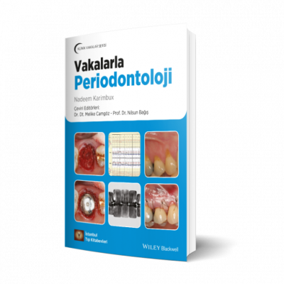 Vakalarla Periodontoloji