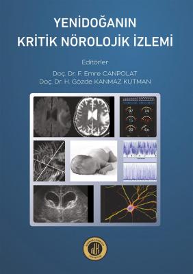 Yenidoğanın Kritik Nörolojik İzlemi